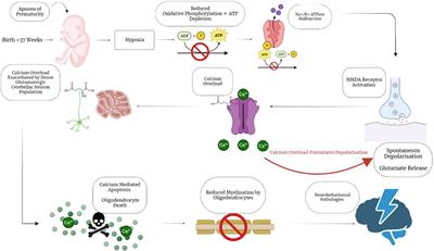 Potential for a cerebellar role in moderate-late preterm associated behavioural disorders